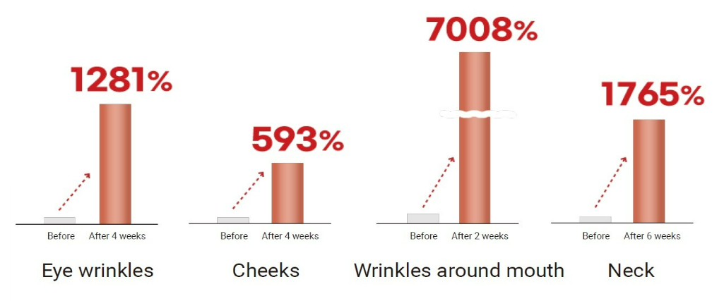 Grafik Data Klinis untuk Kepadatan dan Kelembapan Kulit