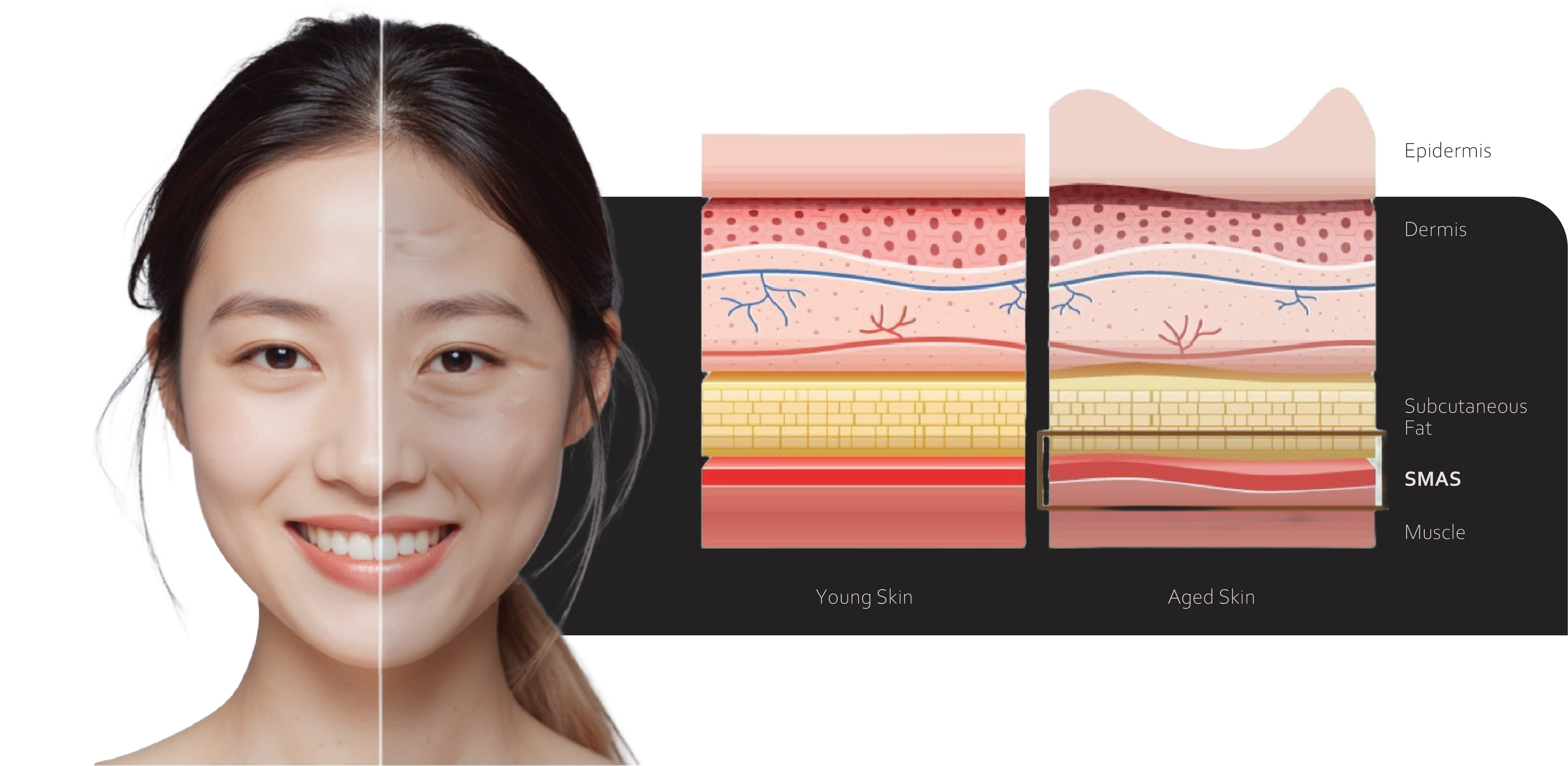 Diagram perbandingan lapisan kulit muda dan tua